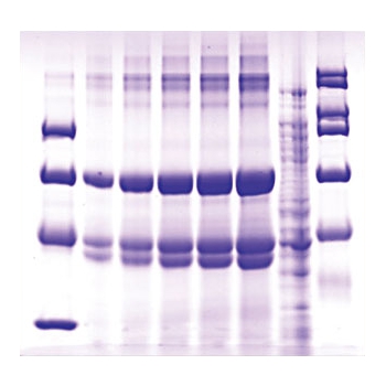 Eletroforese DNA