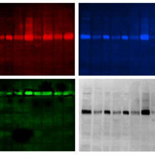 MILTIPLEX FLUORESCENTE
